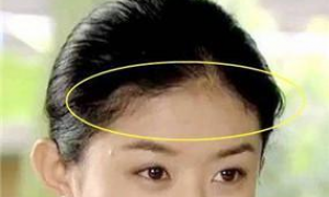 面相发际线图解女人面相分析 发际线与脸型