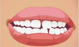 牙齿中间有牙缝的男人面相 牙中间有缝好吗