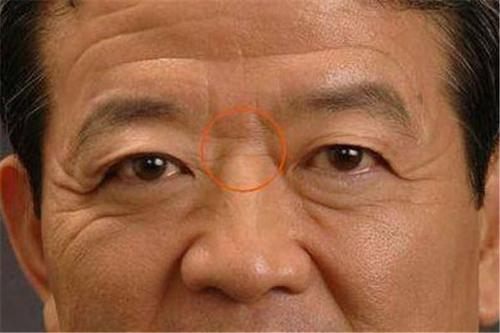 面相鼻子山根山根位与两眼中央的一段鼻梁起点,通常的人也是略略低
